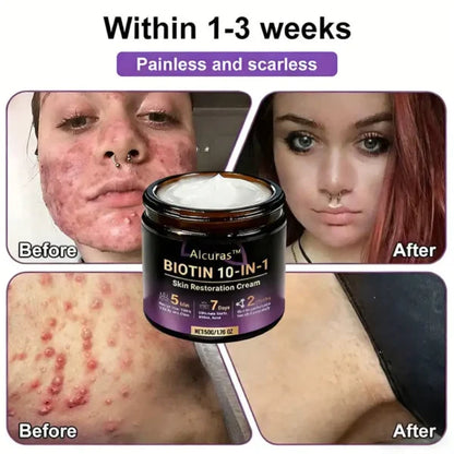 Alcuras Biotin 10-IN-1 Skin Restoration Cream
