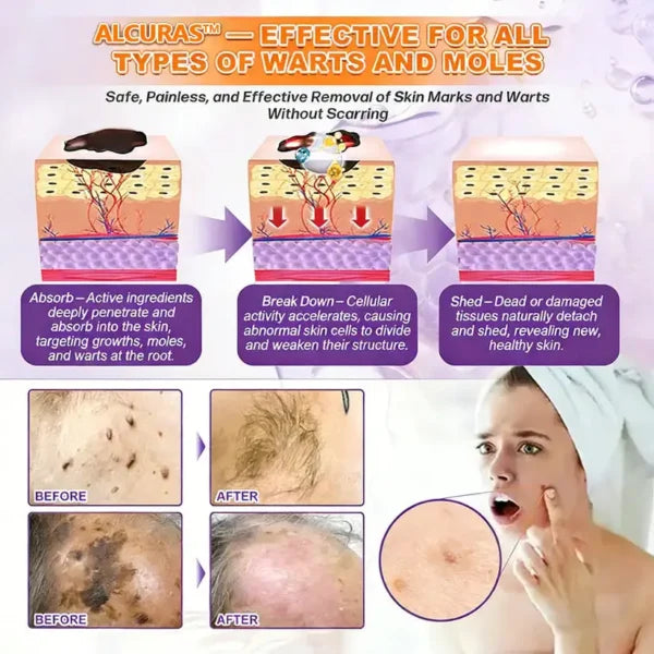 Alcuras Biotin 10-IN-1 Skin Restoration Cream